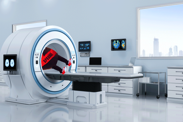 Tertidur?  Minum secangkir kopi dapat mengecilkan otak Anda

 – Beragampengetahuan