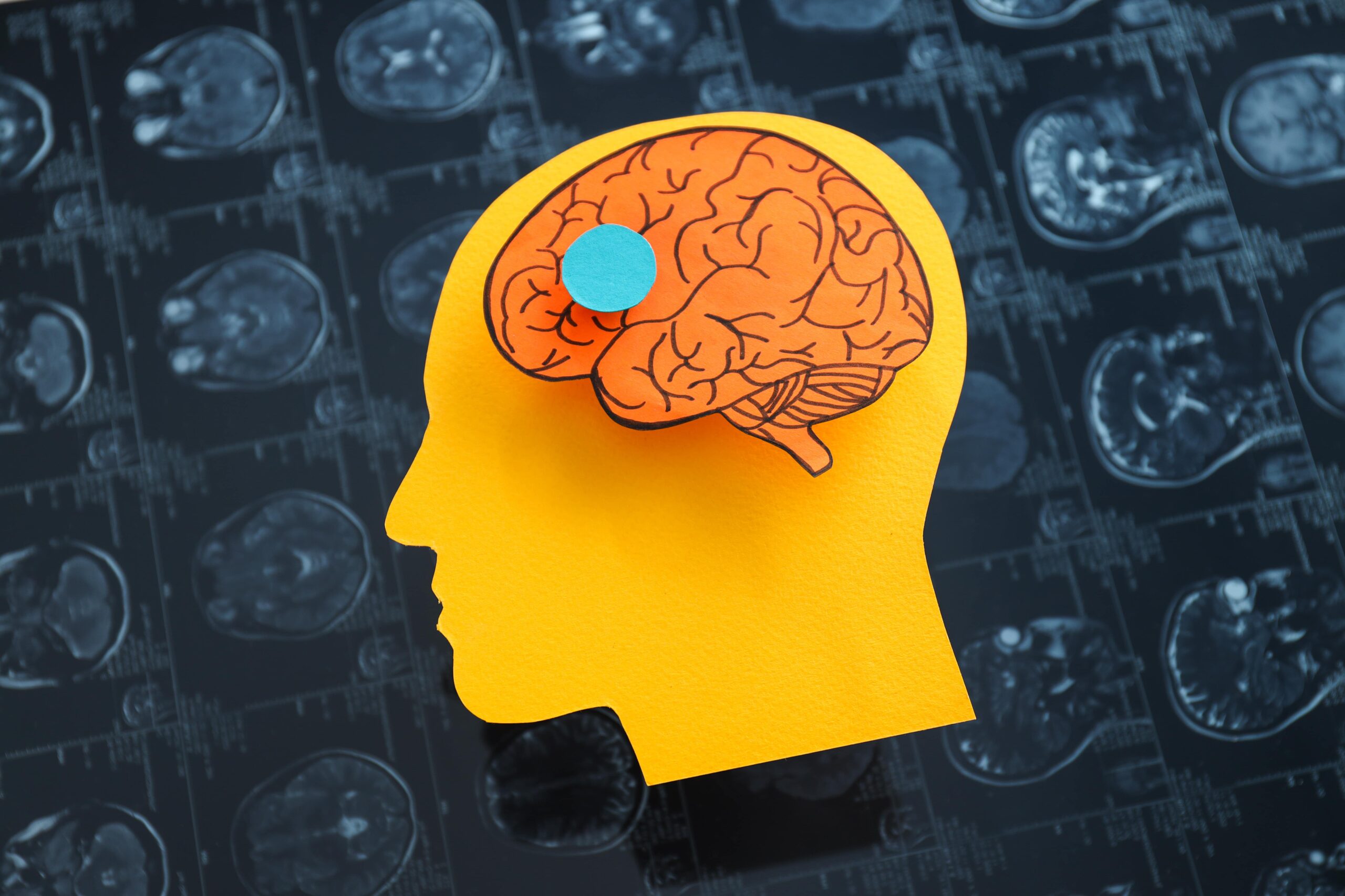 Bagaimana pelatihan otak dapat meningkatkan keterampilan trading Anda?

 – Beragampengetahuan